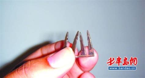 釘子扎腳愈合后長(zhǎng)硬塊一碰就疼(釘子扎腳愈合后長(zhǎng)硬塊一碰就疼怎么回事)縮略圖
