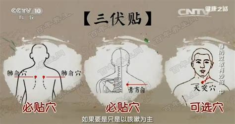 三伏貼貼的正確位置圖,三伏貼貼的正確位置圖祛濕氣縮略圖