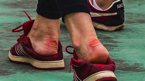 單鞋后跟磨腳的小妙招(鞋后跟一走一掉怎么辦)縮略圖