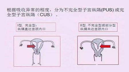 耦合劑進(jìn)入子宮有危害嗎,耦合劑可以進(jìn)入人體嗎縮略圖