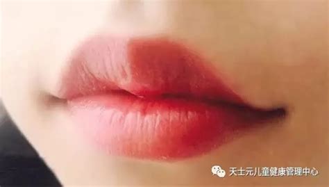 吸嘴唇是什么原因,經(jīng)常吸嘴唇是怎么回事縮略圖